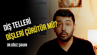 Ortodonti Soru Cevap 3 - Diş telleri dişleri çürütür mü?