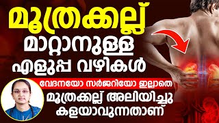 വേദനയോ സർജറിയോ ഇല്ലാതെ മൂത്രക്കല്ല് അലിയിച്ചു കളയാൻ ഉള്ള എളുപ്പവഴികൾ