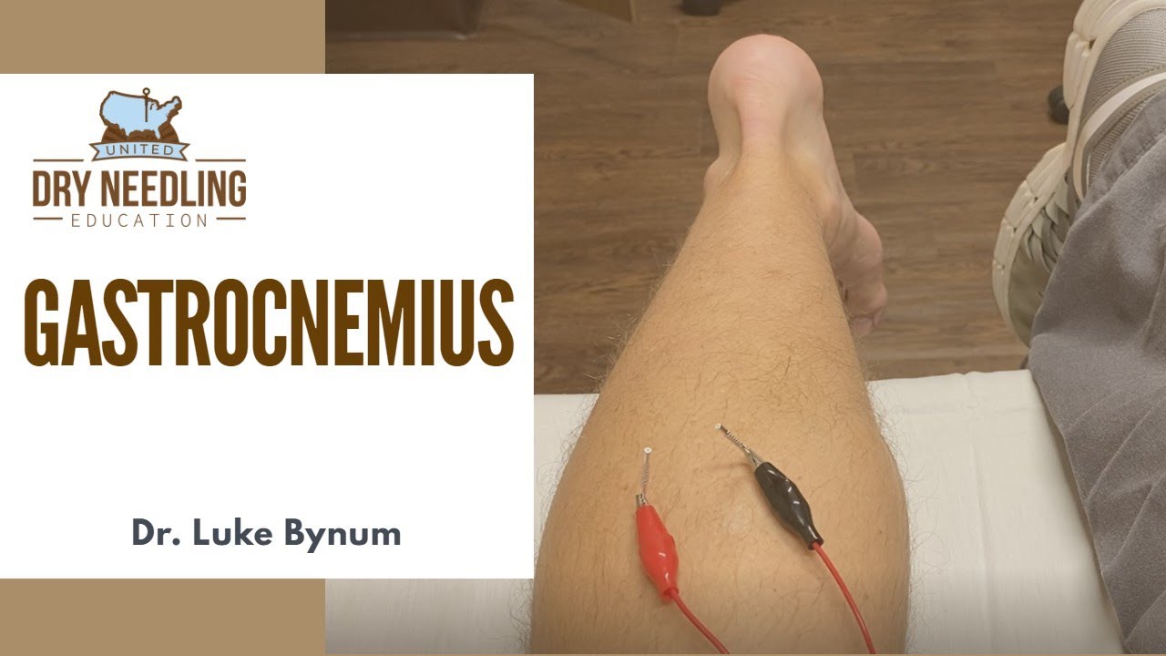 Dry Needling Gastrocnemius - YouTube