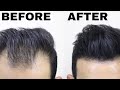 Insane Hair Transformation | Do you need review for this product? Shadhik Azeez #shorts