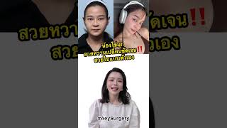 จ่ายเท่าไหร่เปลี่ยนแค่ไหน??? EP.2 😉#ศัลยกรรมเกาหลี #AeySurgery