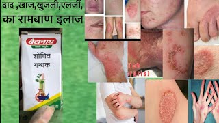 Shodhit Gandhak Benefits, Dosage, Side Effects | Baidyanath, Dabur