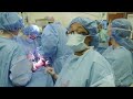 c section and hysterectomy inside the or