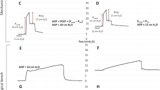 AOP - PRESSÃO DE ABERTURA DE VIAS AÉREAS (NOVO MÉTODO)