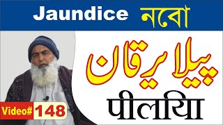 Jaundice ► #148 ► جائینڈس یعنی پیلیا ► নেবা पीलिया ► حکیم محمد اقبال