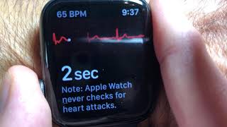 How to use Apple's ECG App on the Apple Watch and Phone