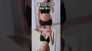 출산 전과 후 비교 #출산 #다이어트 #shorts