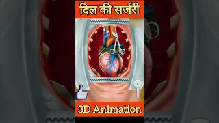 दिल का ऑपरेशन ||3d animation|| #shorts #trending #viral #animation