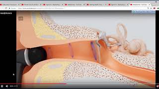 Introducing HearFormPRO B