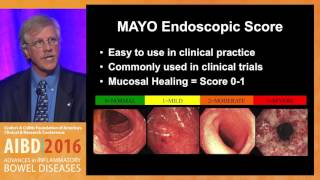 How can we best determine endoscopic severity in ulcerative colitis and Crohn's disease?