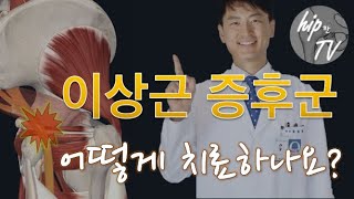 이상근 증후군의 치료 (편집 영상)