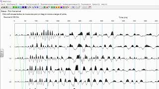 Seisimager2d Seismic Refraction Data Processing Doovi
