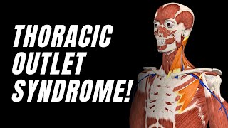 Thoracic Outlet Syndrome Anatomy (You NEED To Know This)