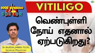 வெண்புள்ளி நோய் எதனால் ஏற்படுகிறது? | EP 166 | Good Evening Doctor