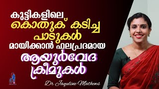 Mosquito bite remedy creams | Ayurvedic creams | കുട്ടികളിലെ കൊതുക് കടിച്ച പാടുകൾ മാറ്റാൻ |