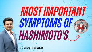 The Most Important Symptoms Of Hashimoto's Disease