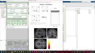 fMRI Analysis with SPM: Second Level Analysis (with GUI)
