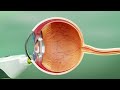 Re-Vana Technology Animation Demonstrates Sustained Release Biologics