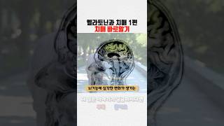 치매 바로알기, 그리고 멜라토닌