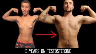 Female To Male Transition - 3 Years On Testosterone