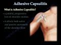 Adhesive Capsulitis ,frozen shoulder. - Everything You Need To Know - Dr. Nabil Ebraheim