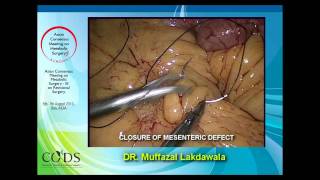 Weight Loss Surgery - Bypass Surgery