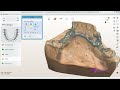 How to design a Removable Partial Framework in #3Shape