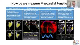 23 08 24 Dr Aisling Smith   Myocardial Function and Pulmonary Haemodynamics in Trisomy 21 Infants