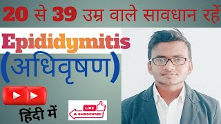 Epididymitis cause, symptoms, treatment and prevention ||अधिवृषण में सूजन के कारण , लक्षण तथा निदान