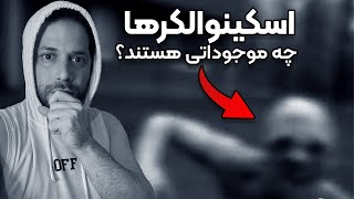 ❌آیا اسکینوالکرها واقعا وجود دارند؟ 😱 واقعی - ترسناک❌