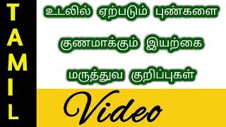 புண்கள், காயம் குணமாக்கும் இயற்கை மருத்துவம்,tamil health tips,Maruthuva Kurippu,tamil video