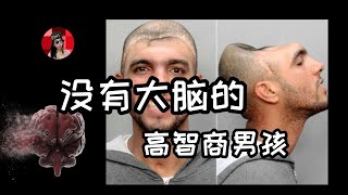 缺失大脑的美国高智商男孩，没有脑子也可以正常生活？