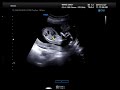 Update /4 months pregnant ultrasound and 3D