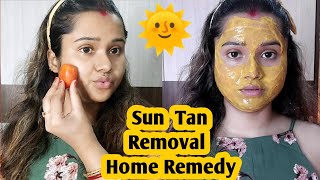 Sun Tan Removal Home Remedies || ঘরোয়া পদ্ধতিতে রোদে পুড়ে যাওয়া ত্বকের কালো দাগ দূর করার উপায় 💕