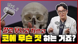 코성형 절골술의 모든 것! 코뼈를 깎고 부러트린다고? | 제이티성형외과 김진태원장