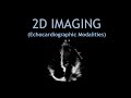 2D IMAGING + Image optimisation! (Echocardiogram).