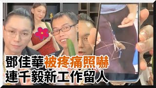 鄧佳華被蝦子夾「蛋」照片嚇瘋　他想離職連千毅給新工作留人｜大公蝦｜抓蝦子｜離家出走