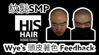 Wye's  頭皮著色紋髮 分享 Scalp Micropigmentation (SMP) HK