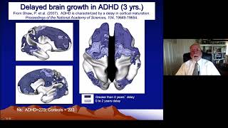 ADHD & Executive Functioning -  Part 2 -  Neuroanatomy of ADHD