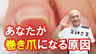 痛くない大阪巻き爪フットケア専門院　爪の原因て何？(巻き爪　陥入爪　外反母趾　足専門）巻き爪　外反母趾　ありがとう鍼灸整骨院/大阪　痛くない巻き爪矯正専門院/大阪茨木市の足神様