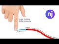 How to Test a Vein for Valves - Nursejanx