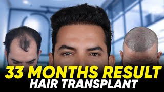 Hair Transplant in Chennai | Best Results \u0026 Cost of Hair Transplant in Chennai