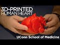 Printing a Heart in 3D