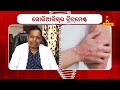 ଚର୍ମ ରୋଗ ଥିଲେ କ’ଣ ଖାଇବା ଉଚିତ୍ psoriasis causes u0026 treatments dr. kishan agrawal swasthyasutra