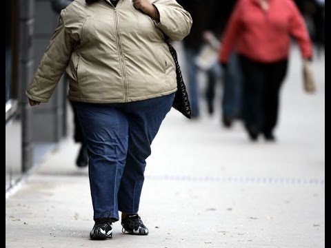 Is obesity a problem in other countries?