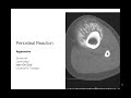 Bone Tumors  - Periosteal Reaction - Radiology Basics