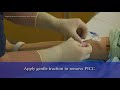 PICC Line Removal