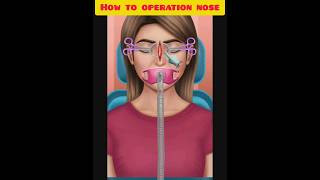 How to operation nose #shorts #ytshorts #3d #3danimation #trending @MRINDIANHACKER @FactTechz