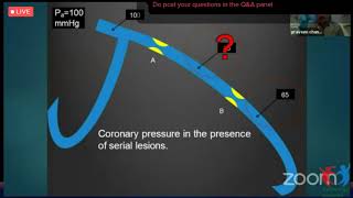 Interventional Cardiology Webinar 2534635654