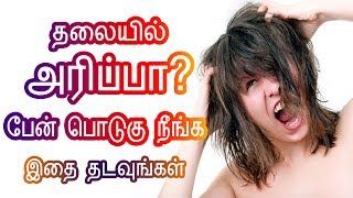 How to Cure Dandruff in Tamil - Cure Itchy Head/Scalp - தலை அரிப்பு? - Tamil Beauty Tips